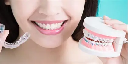 Clear Aligners treatment at Kripa Dental Clinic Bharatpur Chitwan
